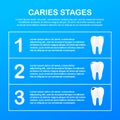 Stage of development of caries. Dental care concept. Healthy Teeth. Vector illustration.